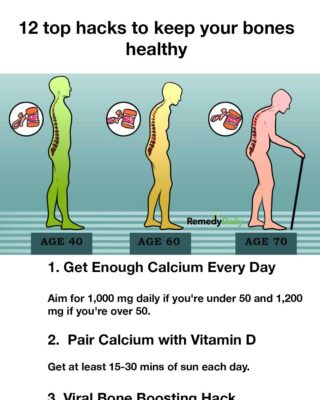 12 top hacks to keep your bones healthy