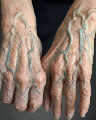 The Truth About Visible Veins in Your Hands: When It’s Normal and When It’s a Signal