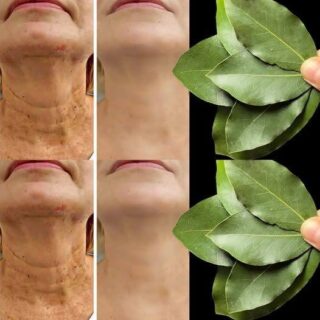 Bay Leaf Is 100,000 Times Stronger Than Botox? | Natural Wrinkle Eraser Even at Age 70!