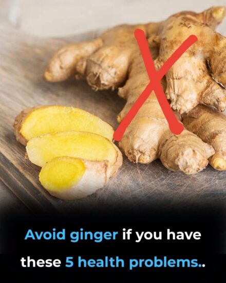 Ginger: When a Superfood Isn’t for You