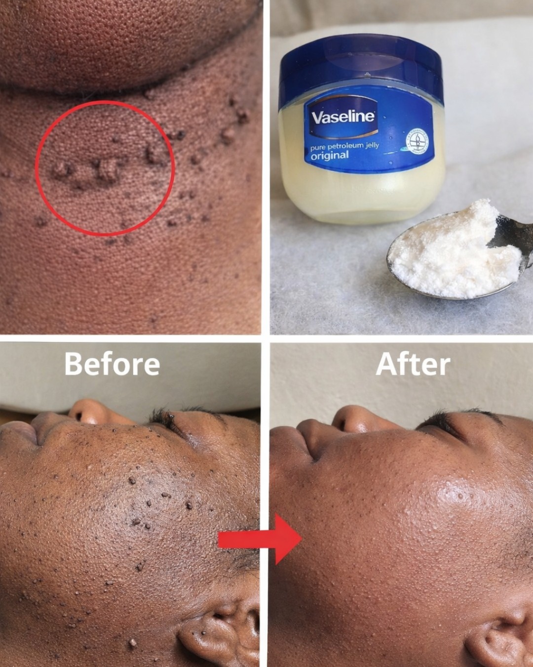 Those Stubborn Little White Bumps: Understanding Milia and Safe Ways to Improve Your Skin’s Appearance