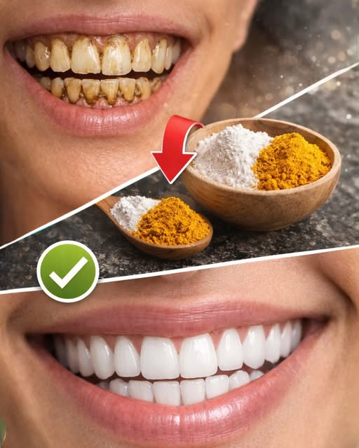 Turmeric and Baking Soda: The Natural Remedy That Cleans, Whitens, and Protects Your Teeth