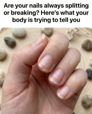 Brittle Nails? 10 Hidden Messages Your Body May Be Sending