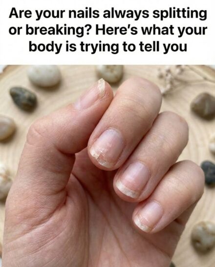 Brittle Nails? 10 Hidden Messages Your Body May Be Sending