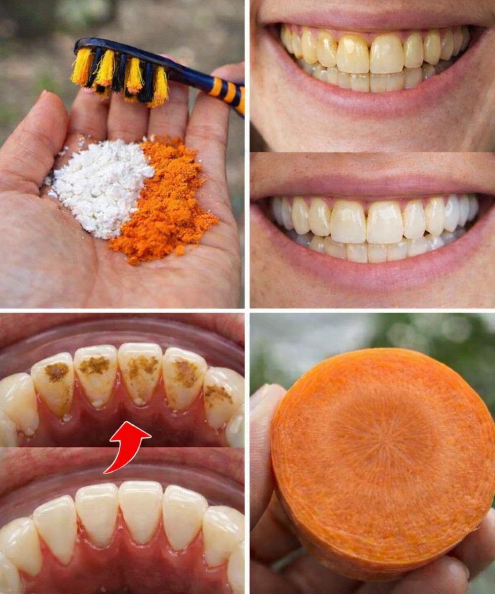 Brighten Your Smile in Minutes: Simple Home Teeth Whitening Tricks That Actually Help