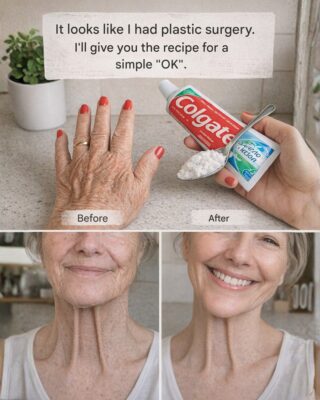 “It Looks Like I Had Plastic Surgery”: The Viral Home Remedy People Are Using to Improve the Appearance of Wrinkles and Dark Spots on Hands and Arms