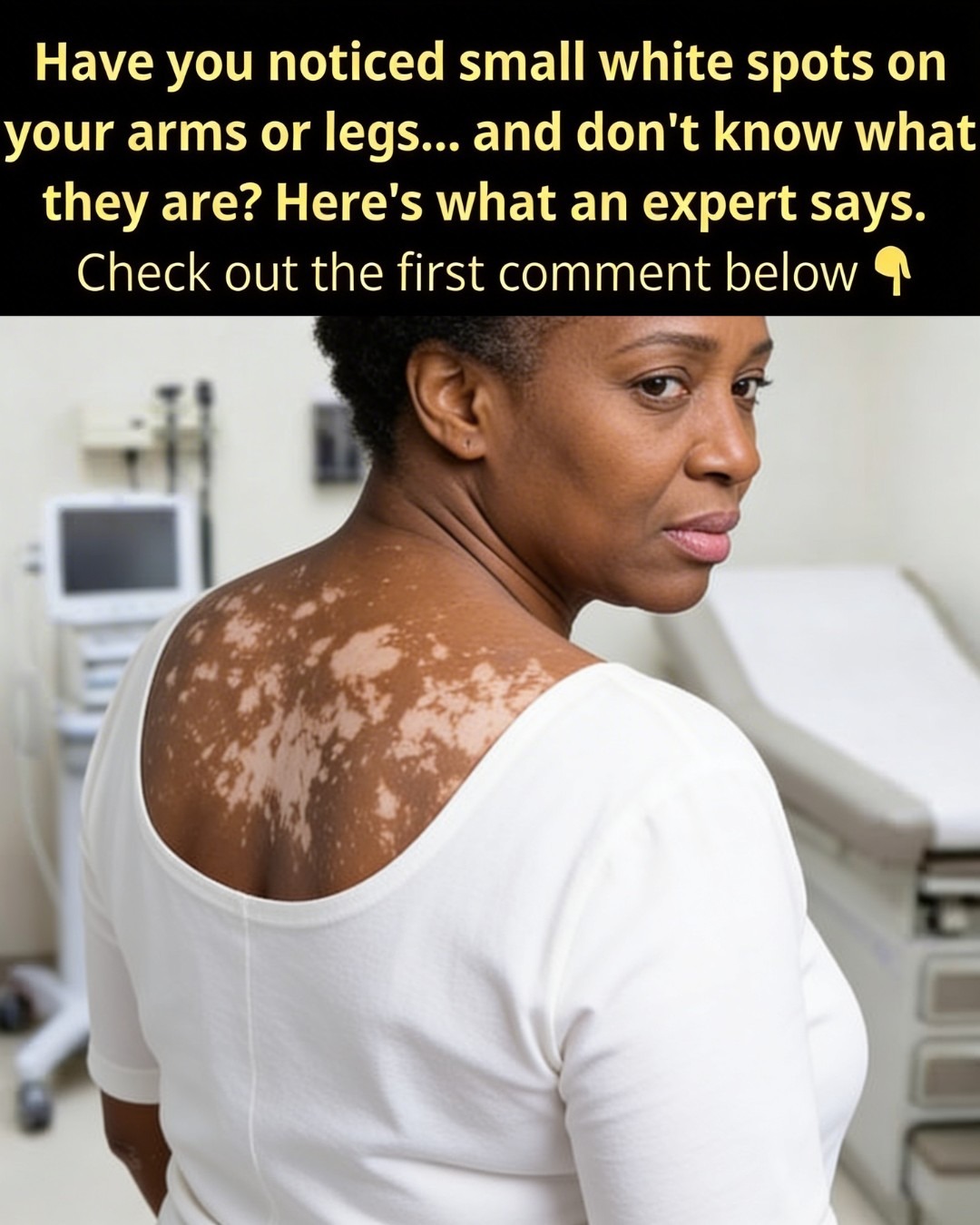 What’s Behind Those Small White Spots on Your Skin? Common Causes to Consider