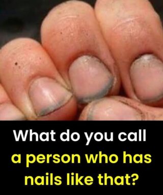 What do you call a person who has nails like that?