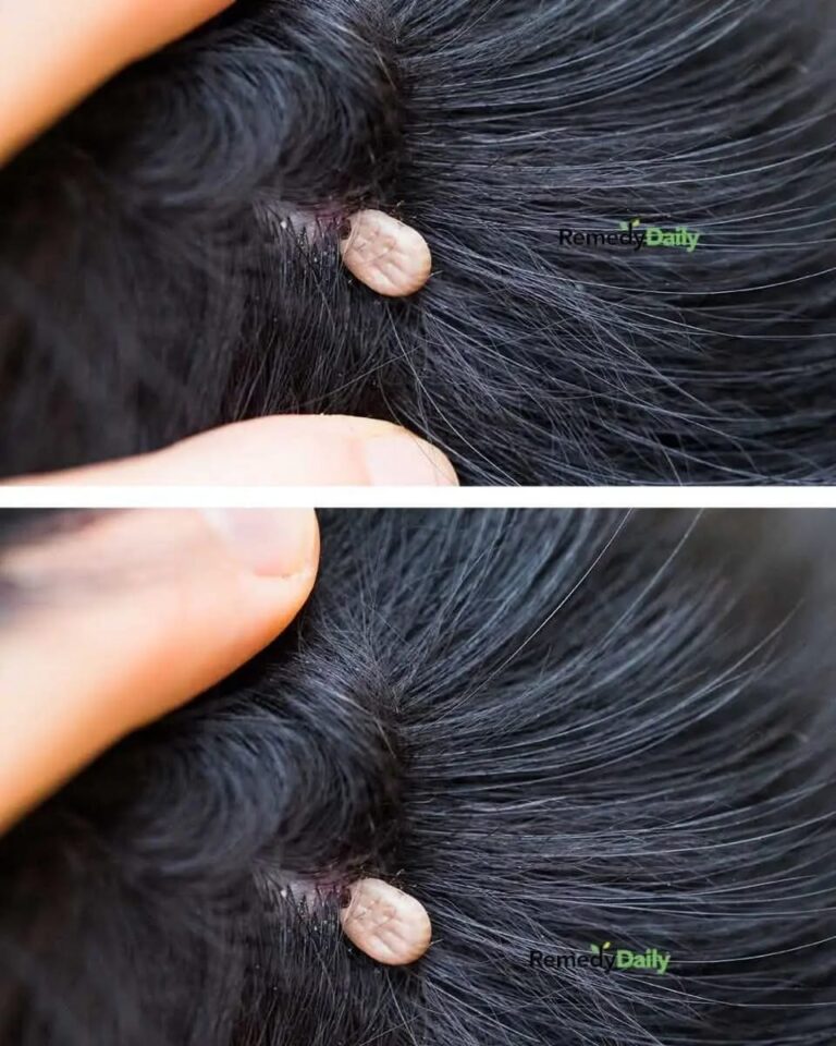 Just discovered this in my son’s hair. What is it? Not sure if we should go to doc