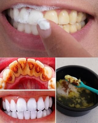Brighten Your Smile Naturally: The Garlic and Baking Soda Mix That May Support Whiter Teeth in Minutes
