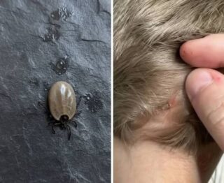 The Little Scalp Invader! What Parents Should Do When a Strange Bug Appears in Their Childs Hair!
