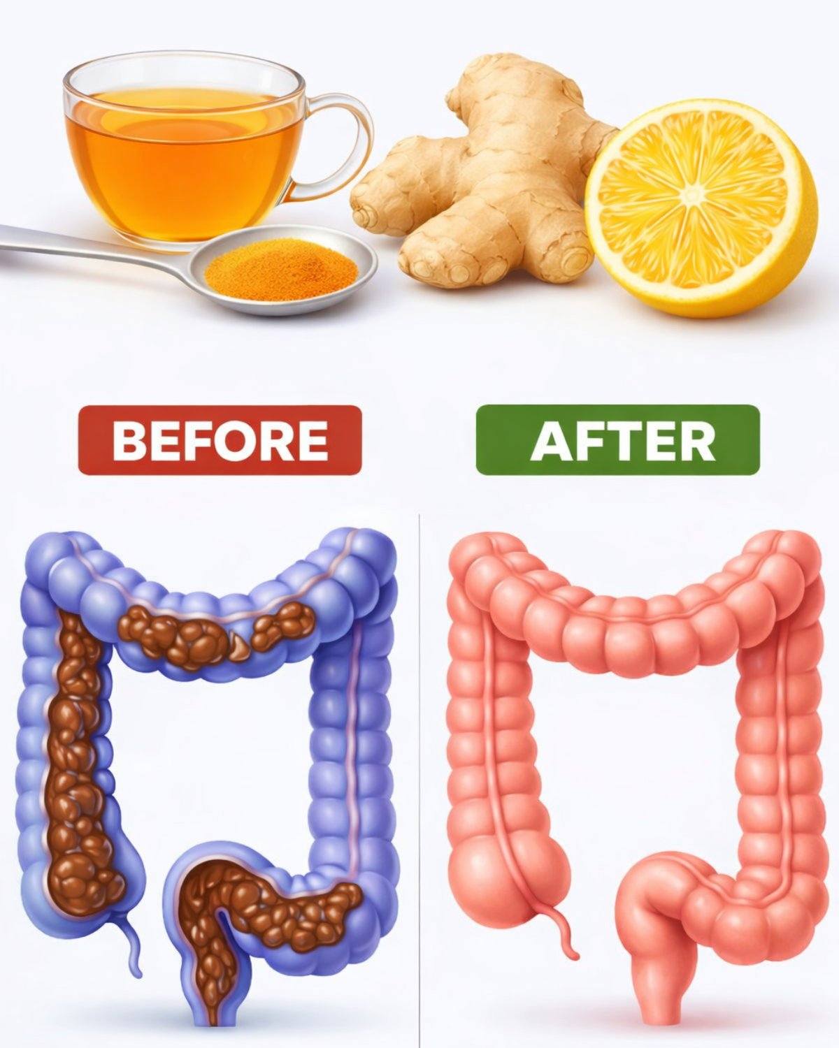 Ginger + Lemon: Colon Cleanse Before & After – What Really Happens When You Try This Simple Drink