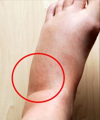 These are the consequences of sleeping with…