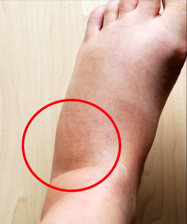 These are the consequences of sleeping with…