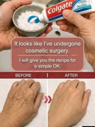 How Toothpaste Can Improve the Appearance of Age Spots and Wrinkles Naturally