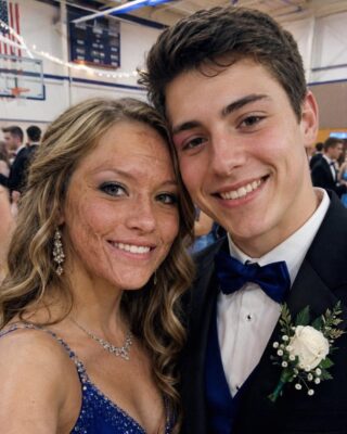 Classmates Avoid Scarred Girl at Prom Until Popular Boy Asks Her to Dance but Next Day Police Reveal His Shocking Ten Year Old Secret