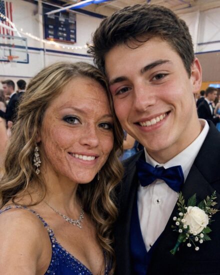 Classmates Avoid Scarred Girl at Prom Until Popular Boy Asks Her to Dance but Next Day Police Reveal His Shocking Ten Year Old Secret